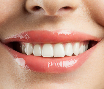 Rochester, MI area dentist describes the procedure for dental implants