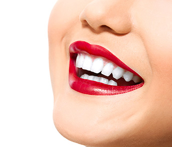 What are the benefits of quality dental bridges in Rochester Hills?