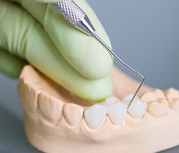 Crown procedure is a versatile way to restore a tooth in Rochester Hills