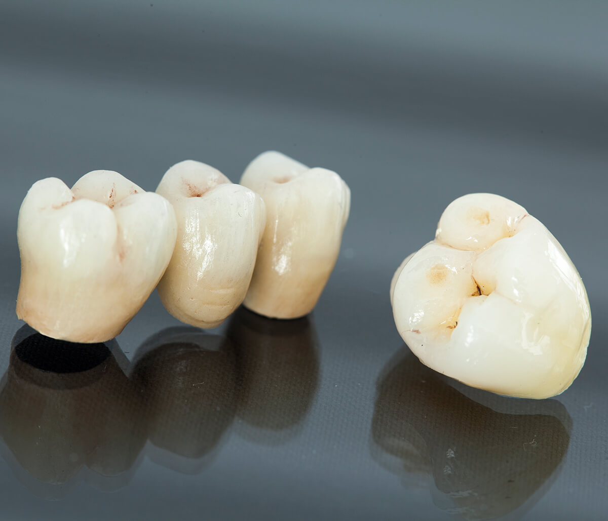 How Sturdy Will My Porcelain Crowns Be in Rochester, MI Area